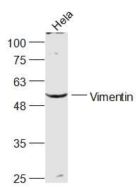 Lane 1: Hela Cell lysate; Probed with Vimentin Polyclonal Antibody, Unconjugated (bs-23063R) at 1:1000 overnight at 4\u00b0C followed by a conjugated secondary antibody for 60 minutes at 37\u00b0C.