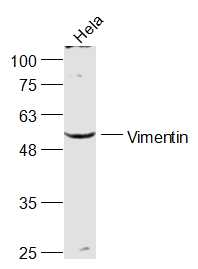 Lane 1: Hela Cell lysate; Probed with Vimentin Polyclonal Antibody, Unconjugated (bs-23063R) at 1:1000 overnight at 4°C followed by a conjugated secondary antibody for 60 minutes at 37°C.