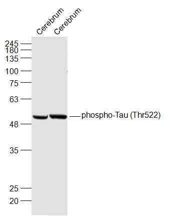 Lane 1: Mouse Cerebrum lysates; Lane 2: Rat Cerebrum lysates probed with phospho-Tau (Thr522)  Polyclonal Antibody, Unconjugated (bs-10113R) at 1:1000 dilution and 4˚C overnight incubation. Followed by conjugated secondary antibody incubation at 1:20000 for 60 min at 37˚C.