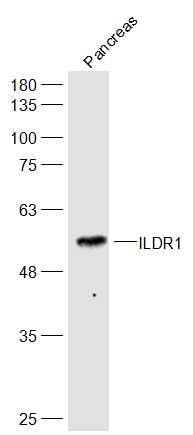 Mouse pancreas Liver lysates probed with ILDR1 Polyclonal Antibody, Unconjugated (bs-10113R) at 1:500 dilution and 4˚C overnight incubation. Followed by conjugated secondary antibody incubation at 1:20000 for 60 min at 37˚C.