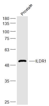 Rat prostate lysates probed with ILDR1 Polyclonal Antibody, Unconjugated (bs-10113R) at 1:500 dilution and 4˚C overnight incubation. Followed by conjugated secondary antibody incubation at 1:20000 for 60 min at 37˚C. Rat prostate lysates probed with ILDR1 Polyclonal Antibody, Unconjugated (bs-10113R) at 1:500 dilution and 4˚C overnight incubation. Followed by conjugated secondary antibody incubation at 1:20000 for 60 min at 37˚C.