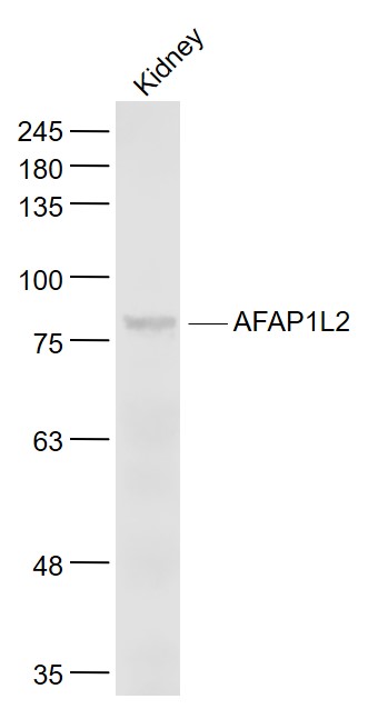 Mouse kidney lysates probed with AFAP1L2 Polyclonal Antibody, Unconjugated (bs-11020R) at 1:1000 dilution and 4˚C overnight incubation. Followed by conjugated secondary antibody incubation at 1:20000 for 60 min at 37˚C.