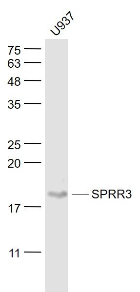 U937 cell lysates probed with SPRR3 Polyclonal Antibody, Unconjugated (bs-11163R) at 1:1000 dilution and 4˚C overnight incubation. Followed by conjugated secondary antibody incubation at 1:20000 for 60 min at 37˚C. U937 cell lysates probed with SPRR3 Polyclonal Antibody, Unconjugated (bs-11163R) at 1:1000 dilution and 4˚C overnight incubation. Followed by conjugated secondary antibody incubation at 1:20000 for 60 min at 37˚C.