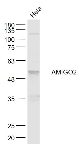 Hela cell lysates probed with AMIGO2 Polyclonal Antibody, Unconjugated (bs-11450R) at 1:1000 dilution and 4˚C overnight incubation. Followed by conjugated secondary antibody incubation at 1:20000 for 60 min at 37˚C.