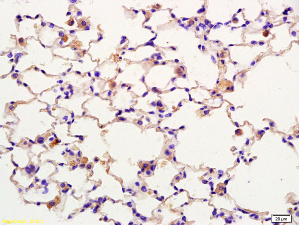 Formalin-fixed and paraffin embedded rat lung labeled with Anti-SPON1/F spondin Polyclonal Antibody, Unconjugated (bs-7520R) at 1:200 followed by conjugation to the secondary antibody and DAB staining.