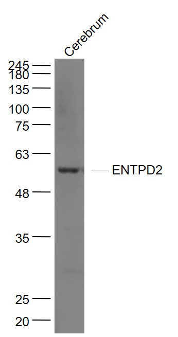 Rat Cerebrum lysates lysates probed with ENTPD2 Polyclonal Antibody, Unconjugated (bs-11515R) at 1:1000 dilution and 4˚C overnight incubation. Followed by conjugated secondary antibody incubation at 1:20000 for 60 min at 37˚C.
