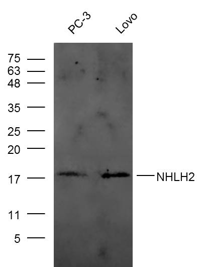 Lane 1: PC-3 cell lysates; Lane 2: Lovo cell lysates probed with NHLH2 Polyclonal Antibody, Unconjugated (bs-11524R) at 1:300 dilution and 4˚C overnight incubation. Followed by conjugated secondary antibody incubation at 1:20000 for 60 min at 37˚C.