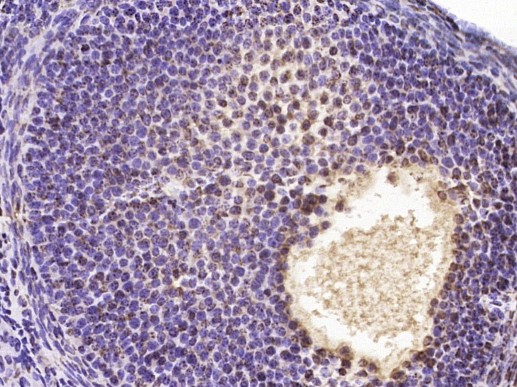 Paraformaldehyde-fixed, paraffin embedded Mouse ovarian; Antigen retrieval by boiling in sodium citrate buffer (pH6.0) for 15min; Block endogenous peroxidase by 3% hydrogen peroxide for 20 minutes; Blocking buffer (normal goat serum) at 37°C for 30min; Antibody incubation with GCX1/C20orf100 Polyclonal Antibody, Unconjugated (bs-11402R) at 1:400 overnight at 4°C, DAB staining.