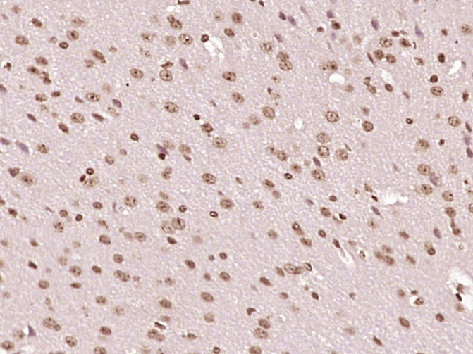 Paraformaldehyde-fixed, paraffin embedded Mouse brain; Antigen retrieval by boiling in sodium citrate buffer (pH6.0) for 15min; Block endogenous peroxidase by 3% hydrogen peroxide for 20 minutes; Blocking buffer (normal goat serum) at 37°C for 30min; Antibody incubation with GCX1/C20orf100 Polyclonal Antibody, Unconjugated (bs-11402R) at 1:400 overnight at 4°C, DAB staining.