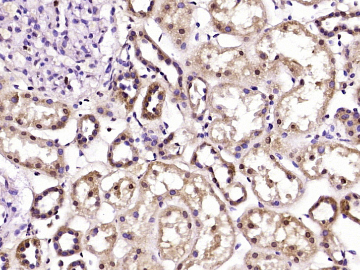 Paraformaldehyde-fixed, paraffin embedded Human kidney; Antigen retrieval by boiling in sodium citrate buffer (pH6.0) for 15min; Block endogenous peroxidase by 3% hydrogen peroxide for 20 minutes; Blocking buffer (normal goat serum) at 37°C for 30min; Antibody incubation with UBXD2 Polyclonal Antibody, Unconjugated (bs-11675R) at 1:400 overnight at 4°C, DAB staining.