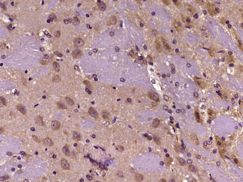 Paraformaldehyde-fixed, paraffin embedded Rat brain; Antigen retrieval by boiling in sodium citrate buffer (pH6.0) for 15min; Block endogenous peroxidase by 3% hydrogen peroxide for 20 minutes; Blocking buffer (normal goat serum) at 37°C for 30min; Antibody incubation with KCTD17 Polyclonal Antibody, Unconjugated (bs-16929R) at 1:400 overnight at 4°C, DAB staining.