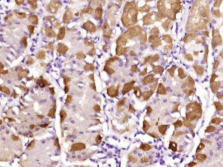 Paraformaldehyde-fixed, paraffin embedded Human stomach; Antigen retrieval by boiling in sodium citrate buffer (pH6.0) for 15min; Block endogenous peroxidase by 3% hydrogen peroxide for 20 minutes; Blocking buffer (normal goat serum) at 37°C for 30min; Antibody incubation with MyoD family inhibitor Polyclonal Antibody, Unconjugated (bs-18743R) at 1:400 overnight at 4°C, DAB staining.