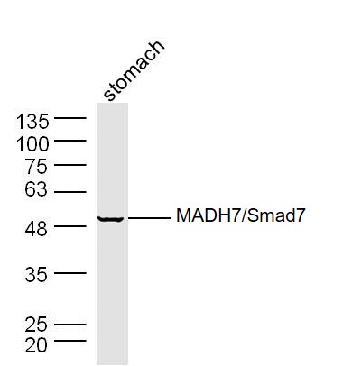 Mouse stomach lysates probed with Smad7 Polyclonal Antibody, Unconjugated (bs-0566R) at 1:300 dilution and 4˚C overnight incubation. Followed by conjugated secondary antibody incubation at 1:20000 for 60 min at 37˚C.