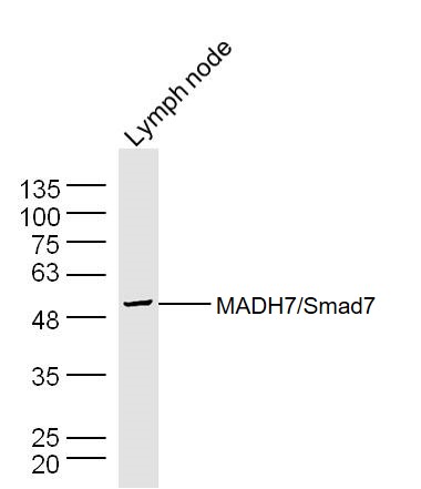 Mouse lymph node lysates probed with Smad7 Polyclonal Antibody, Unconjugated (bs-0566R) at 1:300 dilution and 4˚C overnight incubation. Followed by conjugated secondary antibody incubation at 1:20000 for 60 min at 37˚C.