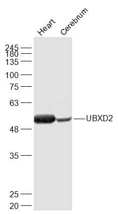 Lane 1: Mouse heart lysates; Lane 2: Rat Cerebrum lysates probed with UBXD2 Polyclonal Antibody, Unconjugated (bs-11675R) at 1:1000 dilution and 4˚C overnight incubation. Followed by conjugated secondary antibody incubation at 1:20000 for 60 min at 37˚C.