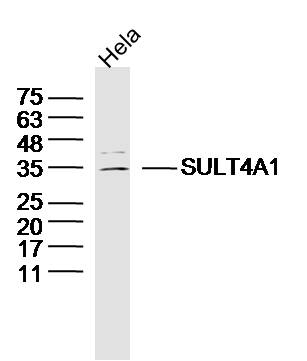 Hela cell lysates probed with SULT4A1 Polyclonal Antibody, Unconjugated (bs-11763R) at 1:300 dilution and 4˚C overnight incubation. Followed by conjugated secondary antibody incubation at 1:20000 for 60 min at 37˚C.