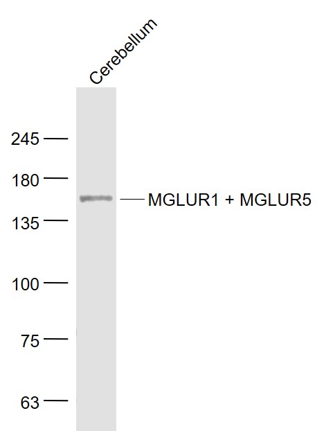 Mouse cerebellum lysates probed with MGLUR1 + MGLUR5 Polyclonal Antibody, Unconjugated (bs-12014R) at 1:1000 dilution and 4˚C overnight incubation. Followed by conjugated secondary antibody incubation at 1:20000 for 60 min at 37˚C.