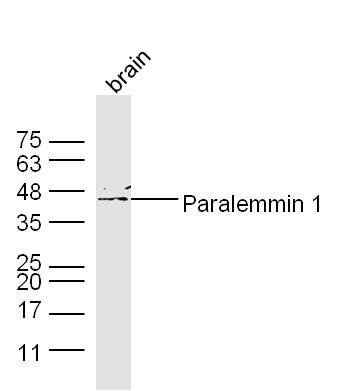 Mouse Cerebrum lysates probed with Paralemmin 1 Polyclonal Antibody, Unconjugated (bs-12035R) at 1:300 dilution and 4˚C overnight incubation. Followed by conjugated secondary antibody incubation at 1:20000 for 60 min at 37˚C.