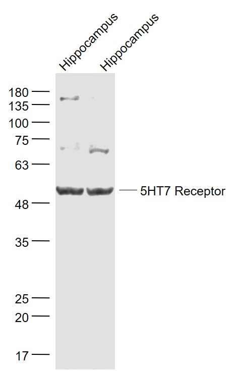 Lane 1: Mouse Hippocampus lysates; Lane 2: Rat Hippocampus lysates probed with 5HT7 Receptor Polyclonal Antibody, Unconjugated (bs-12056R) at 1:1000 dilution and 4˚C overnight incubation. Followed by conjugated secondary antibody incubation at 1:20000 for 60 min at 37˚C.