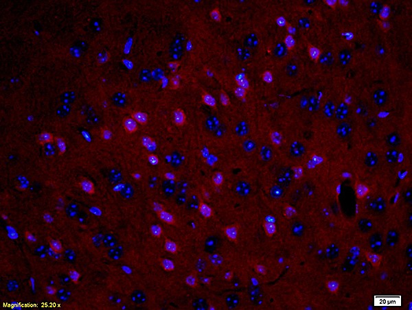 Formalin-fixed and paraffin embedded: rat brain tissue labeled with  Anti-MBP Polyclonal Antibody (bs-0380R), Unconjugated at 1:200, followed by conjugation to the secondary antibody was Goat Anti-Rabbit IgG, PE conjugated (bs-0295G-PE) at 1:200 for 40 minutes at 37\u00b0C DAPI(5ug\/ml, blue) was used to stain the cell nuclei