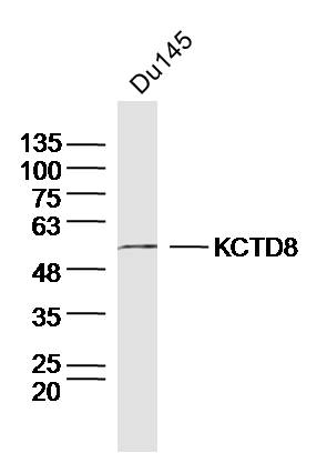 DU145 cell lysates probed with KCTD8 Polyclonal Antibody, Unconjugated (bs-12087R) at 1:300 dilution and 4˚C overnight incubation. Followed by conjugated secondary antibody incubation at 1:20000 for 60 min at 37˚C.
