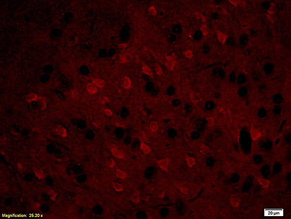 Formalin-fixed and paraffin embedded: rat brain tissue labeled with Anti-MBP Polyclonal Antibody (bs-0380R), Unconjugated at 1:200, followed by conjugation to the secondary antibody was Goat Anti-Rabbit IgG, PE conjugated (bs-0295G-PE) at 1:200 for 40 minutes at 37\u00b0C