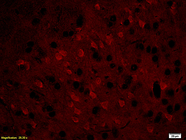 Formalin-fixed and paraffin embedded: rat brain tissue labeled with Anti-MBP Polyclonal Antibody (bs-0380R), Unconjugated at 1:200, followed by conjugation to the secondary antibody was Goat Anti-Rabbit IgG, PE conjugated (bs-0295G-PE) at 1:200 for 40 minutes at 37°C