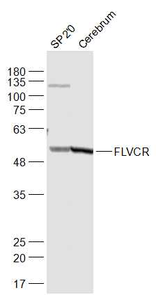 Lane 1: SP2/0 cell lysates; Lane 2: Mouse cerebrum lysates probed with FLVCR Polyclonal Antibody, Unconjugated (bs-12344R) at 1:1000 dilution and 4˚C overnight incubation. Followed by conjugated secondary antibody incubation at 1:20000 for 60 min at 37˚C.