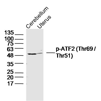 Lane 1: Mouse cerebellum lysates; Lane 2: Mouse uterus lysates probed with ATF2 (Thr69) Polyclonal Antibody, Unconjugated (bs-12538R) at 1:300 dilution and 4˚C overnight incubation. Followed by conjugated secondary antibody incubation at 1:20000 for 60 min at 37˚C.