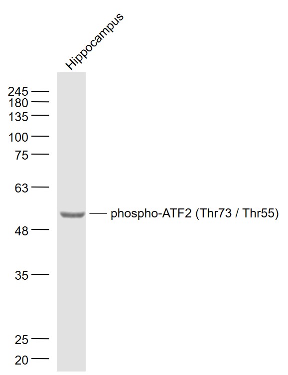 Mouse hippocampus lysates probed with ATF2 (Thr73/Thr55) Polyclonal Antibody, Unconjugated (bs-12539R) at 1:1000 dilution and 4˚C overnight incubation. Followed by conjugated secondary antibody incubation at 1:20000 for 60 min at 37˚C.