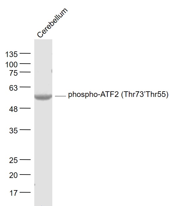 Rat cerebellum lysates probed with ATF2 (Thr73/Thr55) Polyclonal Antibody, Unconjugated (bs-12539R) at 1:1000 dilution and 4˚C overnight incubation. Followed by conjugated secondary antibody incubation at 1:20000 for 60 min at 37˚C.