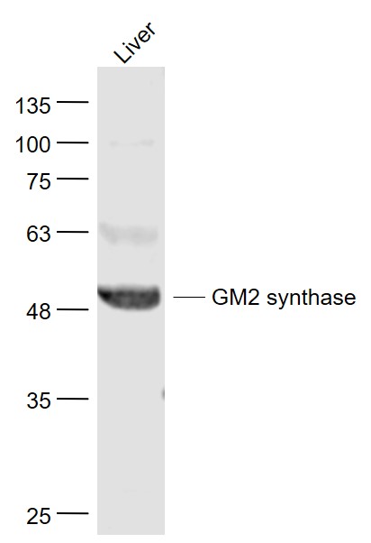 Mouse Liver lysates probed with B4GALNT1/GM2 synthase Polyclonal Antibody, Unconjugated (bs-12706R) at 1:1000 dilution and 4˚C overnight incubation. Followed by conjugated secondary antibody incubation at 1:20000 for 60 min at 37˚C.