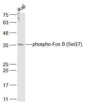 Raji cell lysates probed with phospho-Fos B (Ser27) Polyclonal Antibody, Unconjugated (bs-13198R) at 1:1000 dilution and 4˚C overnight incubation. Followed by conjugated secondary antibody incubation at 1:20000 for 60 min at 37˚C.