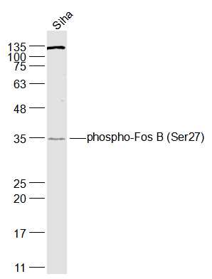 Siha cell lysates probed with phospho-Fos B (Ser27) Polyclonal Antibody, Unconjugated (bs-13198R) at 1:1000 dilution and 4˚C overnight incubation. Followed by conjugated secondary antibody incubation at 1:20000 for 60 min at 37˚C.