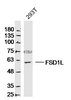 293T cell lysates probed with FSD1L/CCDC10 Polyclonal Antibody, Unconjugated (bs-13221R) at 1:300 dilution and 4˚C overnight incubation. Followed by conjugated secondary antibody incubation at 1:20000 for 60 min at 37˚C. 293T cell lysates probed with FSD1L/CCDC10 Polyclonal Antibody, Unconjugated (bs-13221R) at 1:300 dilution and 4˚C overnight incubation. Followed by conjugated secondary antibody incubation at 1:20000 for 60 min at 37˚C.
