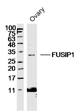 Mouse ovary lysates probed with FUSIP1 Polyclonal Antibody, Unconjugated (bs-13229R) at 1:300 dilution and 4˚C overnight incubation. Followed by conjugated secondary antibody incubation at 1:20000 for 60 min at 37˚C. Mouse ovary lysates probed with FUSIP1 Polyclonal Antibody, Unconjugated (bs-13229R) at 1:300 dilution and 4˚C overnight incubation. Followed by conjugated secondary antibody incubation at 1:20000 for 60 min at 37˚C.