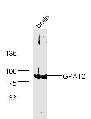 Mouse cerebrum lysates probed with GPAT2 Polyclonal Antibody, Unconjugated (bs-13497R) at 1:300 dilution and 4˚C overnight incubation. Followed by conjugated secondary antibody incubation at 1:20000 for 60 min at 37˚C.