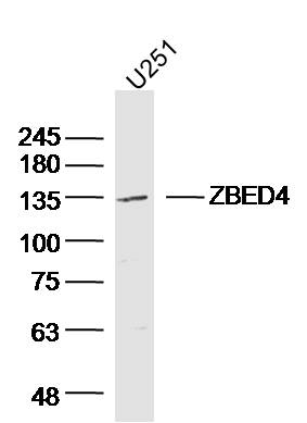 U251 cell lysates probed with ZBED4 Polyclonal Antibody, Unconjugated (bs-13554R) at 1:300 dilution and 4˚C overnight incubation. Followed by conjugated secondary antibody incubation at 1:20000 for 60 min at 37˚C.