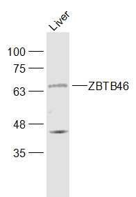 Mouse Liver lysates probed with ZBTB46/BTBD4 Polyclonal Antibody, Unconjugated (bs-13579R) at 1:1000 dilution and 4˚C overnight incubation. Followed by conjugated secondary antibody incubation at 1:20000 for 60 min at 37˚C.
