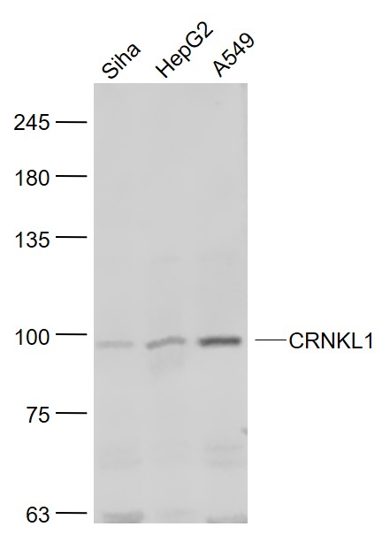 Lane 1: Siha cell lysates;Lane 2: HepG2 cell lysates; Lane 3: A549 cell lysates probed with CRNKL1 Polyclonal Antibody, Unconjugated (bs-14065R) at 1:1000 dilution and 4˚C overnight incubation. Followed by conjugated secondary antibody incubation at 1:20000 for 60 min at 37˚C.