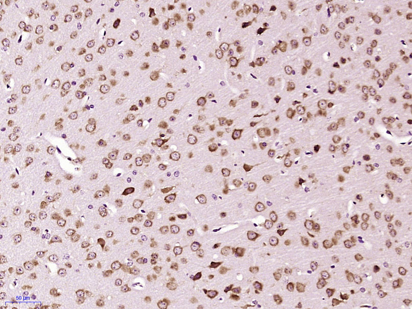 Paraformaldehyde-fixed, paraffin embedded Mouse brain; Antigen retrieval by boiling in sodium citrate buffer (pH6.0) for 15min; Block endogenous peroxidase by 3% hydrogen peroxide for 20 minutes; Blocking buffer (normal goat serum) at 37°C for 30min; Antibody incubation with Mineralocorticoid receptor Polyclonal Antibody, Unconjugated (bs-1850R) at 1:400 overnight at 4°C, followed by secondary and DAB staining.