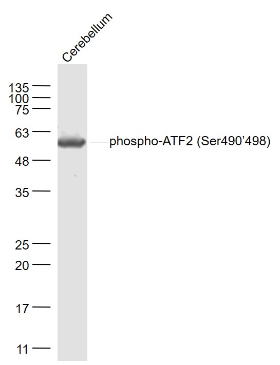 Rat cerebellum lysates probed with phospho-ATF2 (Ser490/498) Polyclonal Antibody, Unconjugated (bs-1648R) at 1:1000 dilution and 4˚C overnight incubation. Followed by conjugated secondary antibody incubation at 1:20000 for 60 min at 37˚C.