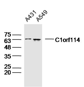 Lane 1: A431 cell lysates; Lane 2: A549 cell lysates probed with C1orf114 Polyclonal Antibody, Unconjugated (bs-15010R) at 1:300 dilution and 4˚C overnight incubation. Followed by conjugated secondary antibody incubation at 1:20000 for 60 min at 37˚C. Lane 1: A431 cell lysates; Lane 2: A549 cell lysates probed with C1orf114 Polyclonal Antibody, Unconjugated (bs-15010R) at 1:300 dilution and 4˚C overnight incubation. Followed by conjugated secondary antibody incubation at 1:20000 for 60 min at 37˚C.