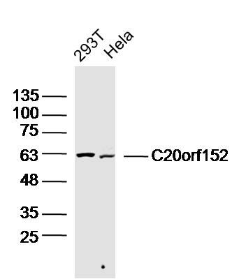 Lane 1: 293T cell lysates; Lane 2: Hela cell lysates probed with C20orf152 Polyclonal Antibody, Unconjugated (bs-15097R) at 1:300 dilution and 4˚C overnight incubation. Followed by conjugated secondary antibody incubation at 1:20000 for 60 min at 37˚C.