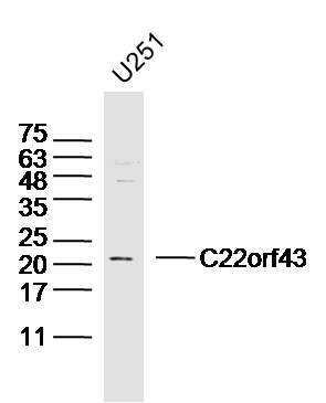 U251 cell lysates probed with C22orf43 Polyclonal Antibody, Unconjugated (bs-15140R) at 1:300 dilution and 4˚C overnight incubation. Followed by conjugated secondary antibody incubation at 1:20000 for 60 min at 37˚C.