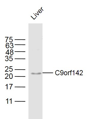 Mouse Liver lysates probed with C9orf142 Polyclonal Antibody, Unconjugated (bs-15315R) at 1:300 dilution and 4˚C overnight incubation. Followed by conjugated secondary antibody incubation at 1:20000 for 60 min at 37˚C.