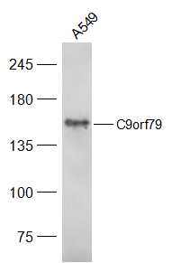 A549 cell lysates probed with C9orf79 Polyclonal Antibody, Unconjugated (bs-1533R) at 1:300 dilution and 4˚C overnight incubation. Followed by conjugated secondary antibody incubation at 1:20000 for 60 min at 37˚C.