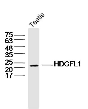 Mouse Testis lysates probed with HDGFL1 Polyclonal Antibody, Unconjugated (bs-15432R) at 1:300 dilution and 4˚C overnight incubation. Followed by conjugated secondary antibody incubation at 1:20000 for 60 min at 37˚C.