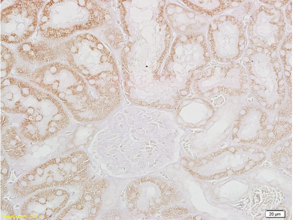 Formalin-fixed and paraffin embedded: rat kidney tissue labeled with Anti-CRF\/CRH Polyclonal Antibody, Unconjugated (bs-0382R)  at 1:200, followed by conjugation to the secondary antibody and DAB staining