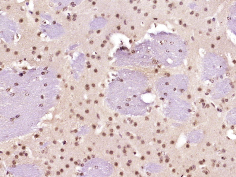 Paraformaldehyde-fixed, paraffin embedded Mouse brain; Antigen retrieval by boiling in sodium citrate buffer (pH6.0) for 15min; Block endogenous peroxidase by 3% hydrogen peroxide for 20 minutes; Blocking buffer (normal goat serum) at 37°C for 30min; Antibody incubation with Activated Notch1 Polyclonal Antibody, Unconjugated (bs-20252R) at 1:400 overnight at 4°C, DAB staining.